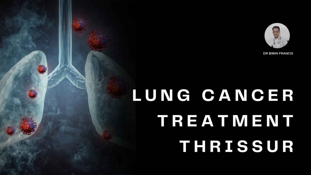 Lung cancer treatment options in Thrissur with Dr. Bibin Francis