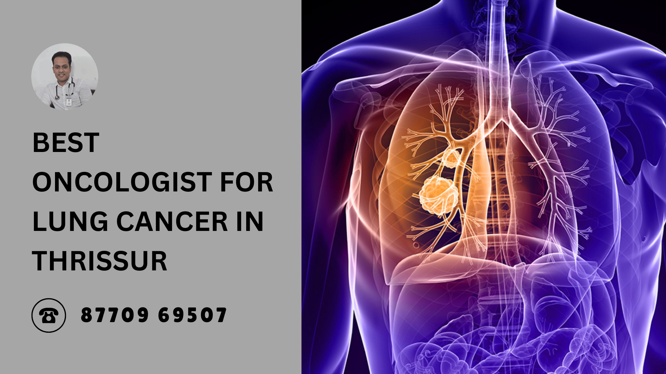 Dr. Bibin Francis, leading oncologist for lung cancer in Thrissur, offering advanced treatments like chemotherapy, immunotherapy, and targeted therapy with a patient-centric, compassionate approach.