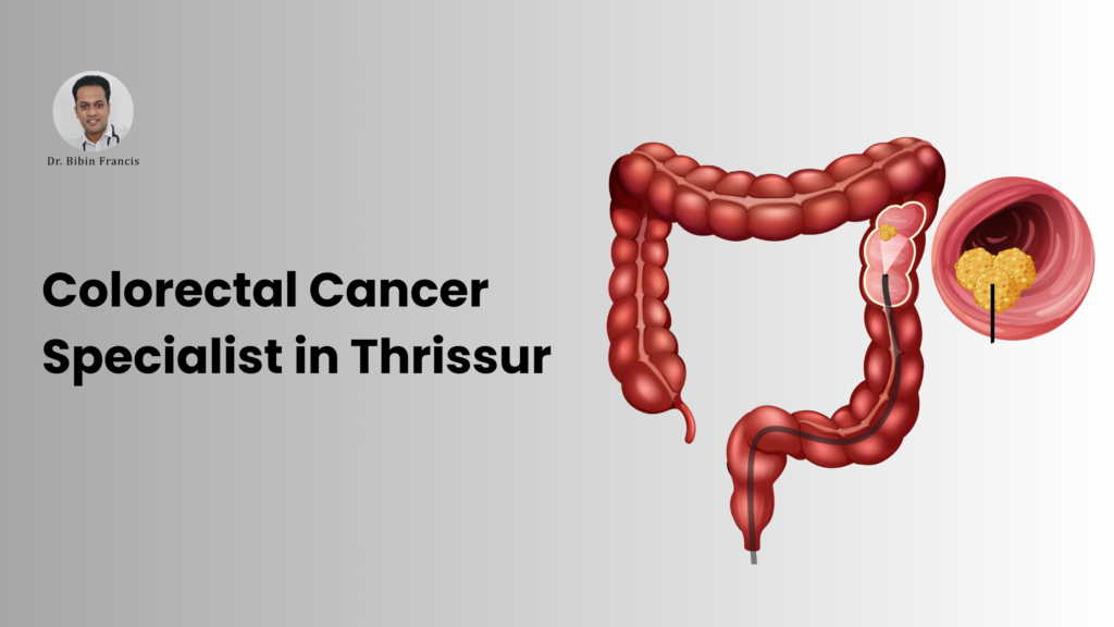 colorectal cancer specialist in Thrissur