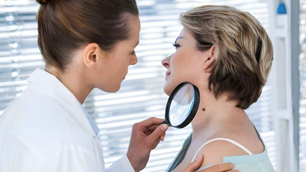 Skin Cancer Consultation