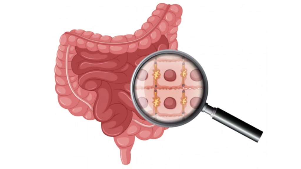 Gastrointestinal Cancer Treatment Risks In Thrissur