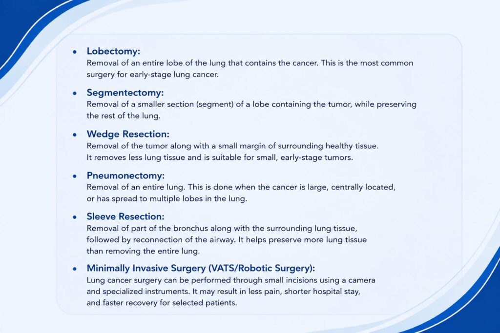 Infographic explaining types of lung cancer surgery, including lobectomy, segmentectomy, wedge resection, pneumonectomy, sleeve resection, and minimally invasive surgery.