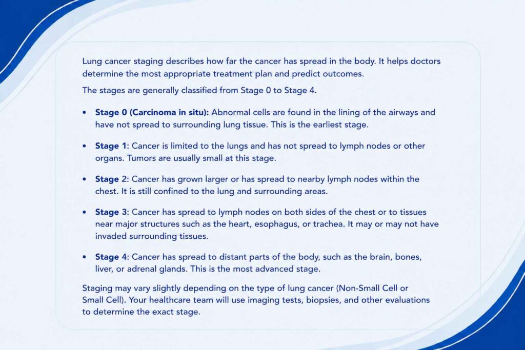 Stages of Lung Cancer infographic explaining Stage 0, Stage 1, Stage 2, Stage 3, and Stage 4 of lung cancer progression and how the disease spreads.