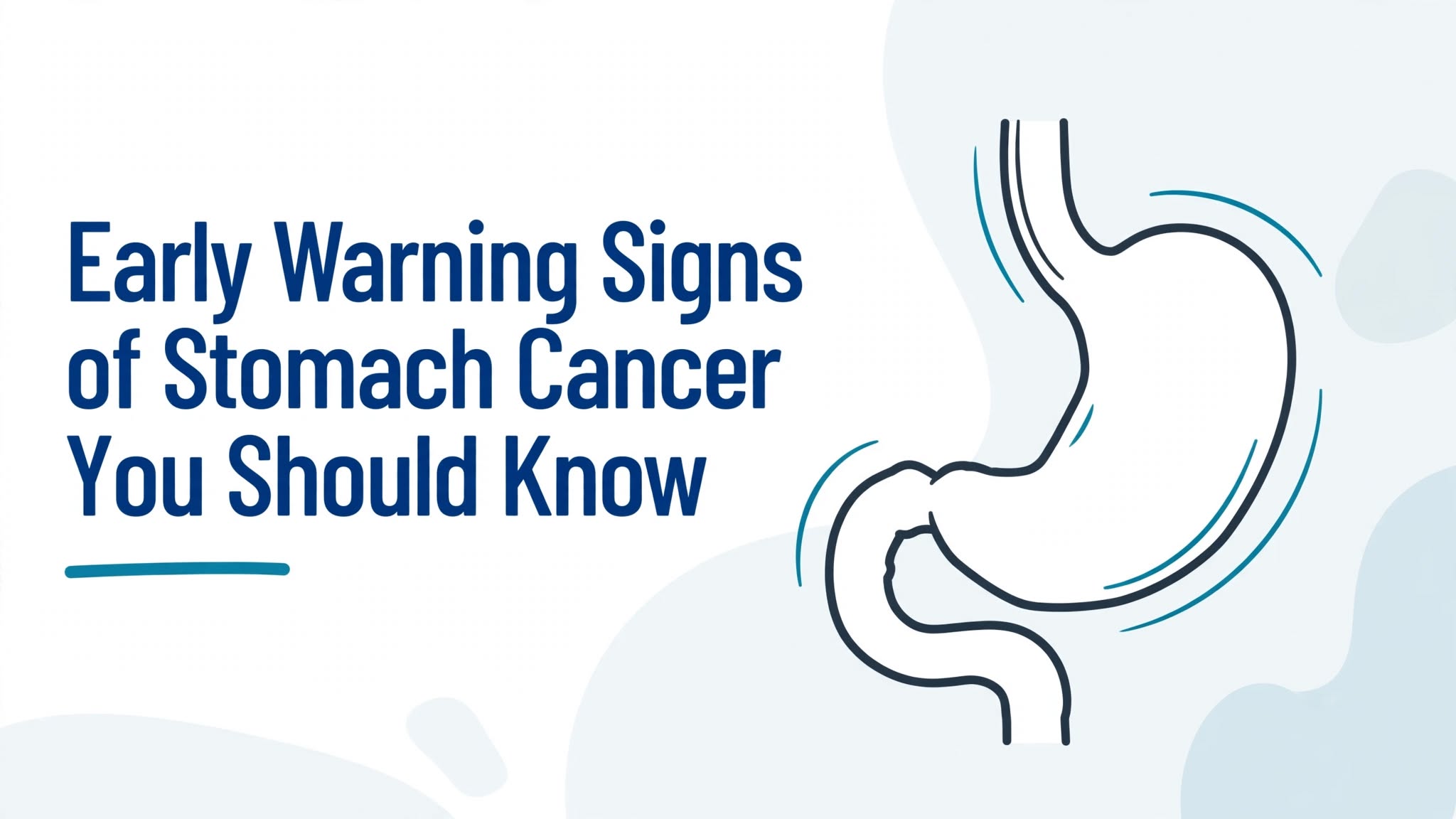Early Warning Signs of Stomach Cancer